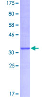 KCNE1 / MinK Protein - 12.5% SDS-PAGE of human KCNE1 stained with Coomassie Blue