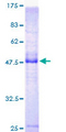 KCNE4 Protein - 12.5% SDS-PAGE of human KCNE4 stained with Coomassie Blue