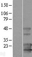 KCNE5 Protein - Western validation with an anti-DDK antibody * L: Control HEK293 lysate R: Over-expression lysate