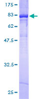 KCNF1 / KCNF Protein - 12.5% SDS-PAGE of human KCNF1 stained with Coomassie Blue