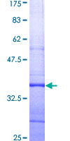 KCNH2 / HERG Protein - 12.5% SDS-PAGE Stained with Coomassie Blue.