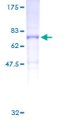 KCNH6 / Kv11.2 / ERG2 Protein - 12.5% SDS-PAGE of human KCNH6 stained with Coomassie Blue