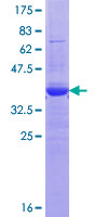 KCNH7 / ERG3 Protein - 12.5% SDS-PAGE Stained with Coomassie Blue.