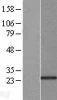 KCNIP1 / KCHIP1 Protein - Western validation with an anti-DDK antibody * L: Control HEK293 lysate R: Over-expression lysate