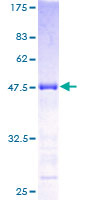 KCNIP1 / KCHIP1 Protein - 12.5% SDS-PAGE of human KCNIP1 stained with Coomassie Blue