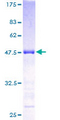 KCNIP1 / KCHIP1 Protein - 12.5% SDS-PAGE of human KCNIP1 stained with Coomassie Blue