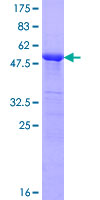 KCNIP2 / KCHIP2 Protein - 12.5% SDS-PAGE of human KCNIP2 stained with Coomassie Blue