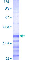 KCNIP2 / KCHIP2 Protein - 12.5% SDS-PAGE Stained with Coomassie Blue.