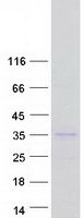 KCNIP2 / KCHIP2 Protein - Purified recombinant protein KCNIP2 was analyzed by SDS-PAGE gel and Coomassie Blue Staining