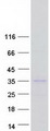 KCNIP2 / KCHIP2 Protein - Purified recombinant protein KCNIP2 was analyzed by SDS-PAGE gel and Coomassie Blue Staining