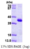KCNIP3 / Dream / Calsenilin Protein
