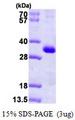 KCNIP3 / Dream / Calsenilin Protein
