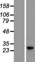 KCNIP4 / KCHIP4 Protein - Western validation with an anti-DDK antibody * L: Control HEK293 lysate R: Over-expression lysate