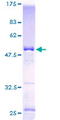 KCNIP4 / KCHIP4 Protein - 12.5% SDS-PAGE of human KCNIP4 stained with Coomassie Blue