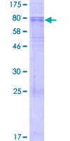 KCNJ1 / ROMK Protein - 12.5% SDS-PAGE of human KCNJ1 stained with Coomassie Blue