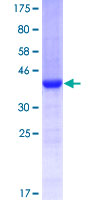 KCNJ1 / ROMK Protein - 12.5% SDS-PAGE Stained with Coomassie Blue.