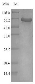 KCNJ10 / SESAME / KIR4.1 Protein - (Tris-Glycine gel) Discontinuous SDS-PAGE (reduced) with 5% enrichment gel and 15% separation gel.