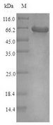 KCNJ10 / SESAME / KIR4.1 Protein - (Tris-Glycine gel) Discontinuous SDS-PAGE (reduced) with 5% enrichment gel and 15% separation gel.