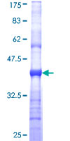 KCNJ10 / SESAME / KIR4.1 Protein - 12.5% SDS-PAGE Stained with Coomassie Blue.