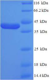 KCNJ10 / SESAME / KIR4.1 Protein
