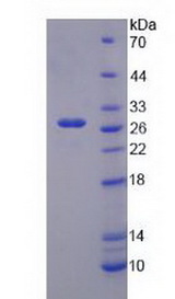 KCNJ10 / SESAME / KIR4.1 Protein - Recombinant  Potassium Inwardly Rectifying Channel Subfamily J, Member 10 By SDS-PAGE