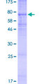 KCNJ11 / Kir6.2 Protein - 12.5% SDS-PAGE of human KCNJ11 stained with Coomassie Blue
