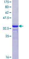 KCNJ11 / Kir6.2 Protein - 12.5% SDS-PAGE Stained with Coomassie Blue.
