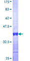 KCNJ16 / Kir5.1 Protein - 12.5% SDS-PAGE Stained with Coomassie Blue.