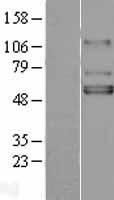 KCNJ3 / GIRK1 Protein - Western validation with an anti-DDK antibody * L: Control HEK293 lysate R: Over-expression lysate