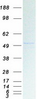 KCNJ5 / Kir3.4 / GIRK4 Protein - Purified recombinant protein KCNJ5 was analyzed by SDS-PAGE gel and Coomassie Blue Staining