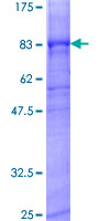 KCNJ6 / GIRK2 Protein - 12.5% SDS-PAGE of human KCNJ6 stained with Coomassie Blue
