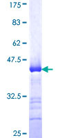 KCNK10 / TREK Protein - 12.5% SDS-PAGE Stained with Coomassie Blue.