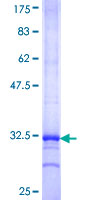 KCNK12 Protein - 12.5% SDS-PAGE Stained with Coomassie Blue.