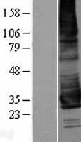 KCNK17 Protein - Western validation with an anti-DDK antibody * L: Control HEK293 lysate R: Over-expression lysate