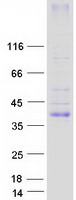 KCNK17 Protein - Purified recombinant protein KCNK17 was analyzed by SDS-PAGE gel and Coomassie Blue Staining