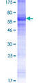 KCNK18 / TRESK Protein - 12.5% SDS-PAGE of human KCNK18 stained with Coomassie Blue