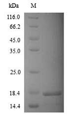 KCNK2 / TREK-1 Protein - (Tris-Glycine gel) Discontinuous SDS-PAGE (reduced) with 5% enrichment gel and 15% separation gel.