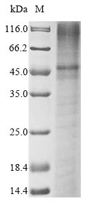 KCNK3 / OAT1 Protein - (Tris-Glycine gel) Discontinuous SDS-PAGE (reduced) with 5% enrichment gel and 15% separation gel.