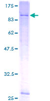 KCNK5 / TASK2 Protein - 12.5% SDS-PAGE of human KCNK5 stained with Coomassie Blue