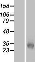 KCNK7 / K2p7.1 Protein - Western validation with an anti-DDK antibody * L: Control HEK293 lysate R: Over-expression lysate