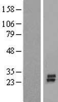 KCNK7 / K2p7.1 Protein - Western validation with an anti-DDK antibody * L: Control HEK293 lysate R: Over-expression lysate