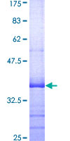 KCNMB1 Protein - 12.5% SDS-PAGE Stained with Coomassie Blue.