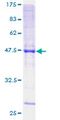 KCNMB2 Protein - 12.5% SDS-PAGE of human KCNMB2 stained with Coomassie Blue
