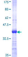 KCNMB3 Protein - 12.5% SDS-PAGE Stained with Coomassie Blue.