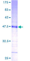 KCNMB4 Protein - 12.5% SDS-PAGE of human KCNMB4 stained with Coomassie Blue