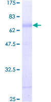 KCNN3 / SK3 Protein - 12.5% SDS-PAGE of human KCNN3 stained with Coomassie Blue
