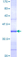 KCNN3 / SK3 Protein - 12.5% SDS-PAGE Stained with Coomassie Blue.