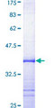 KCNN4 / KCa3.1 Protein - 12.5% SDS-PAGE Stained with Coomassie Blue.