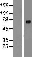 KCNQ1 / KVLQT1 Protein - Western validation with an anti-DDK antibody * L: Control HEK293 lysate R: Over-expression lysate