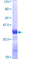 KCNQ4 Protein - 12.5% SDS-PAGE Stained with Coomassie Blue.